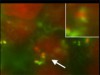 Estudo descobre receptor na variante da E.coli que pode ajudar a explicar por que pessoas com estresse são mais suscetíveis a infecções (reprodução/Fapesp)