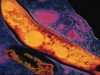 O Mycobacterium tuberculosis, que causa a tuberculose (também conhecido como bacilo de Koch)
