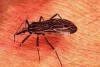 Sem tratamento médico, a doença de Chagas pode afetar o coração e o aparelho digestivo (Foto: Divulgação)
