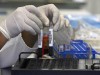 Análises indicam tipo de infecção e melhor tratamento (Foto: Ricardo Oliveira)