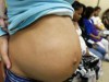 Em quatro anos, foram identificados 535 casos de grávidas com malária no AM (Foto:Robson Fernandes/AE)