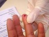 Teste rápido para exame de hepatite (Foto: Divulgação)