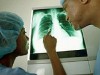 Tuberculose pulmonar é a mais comum (Foto: Divulgação)