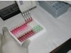Análise laboratorial de sangue (Foto: Acervo pesquisador)