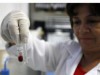 Análise de sangue para diagnosticar vírus da Hepatite B (Foto: Ricardo Oliveira)