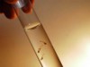 Larvas de mosquito da dengue (Foto: Divulgação)