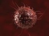 Célula cancerígena do HPV (Arte: Reprodução)