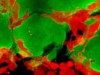 Células-tronco cancerígenas infectadas com virus (em verde, na imagem) começam a morrer (Foto: Divulgação/ Instituto Paul Ehrlich)