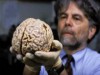 Cérebro humano tem menos neurônios (Foto: Reprodução)