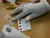 Estudo realizado com 175 pacientes do Amazonas concluiu que anemia é determinante para combate e tratamento da malária  (Foto: Divulgação/Ministério da Saúde)