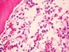 A parte do DNA viral responsável por causar doenças é retirada antes do procedimento (Foto: Reprodução)
