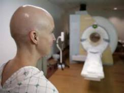 O estudo demonstra a importância do acompanhamento odontológico em pacientes que se submetem ao tratamento radioterápico (Imagem: Reprodução)