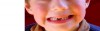 denticaobb