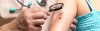 medico-examina-melanoma-20110524-size-598