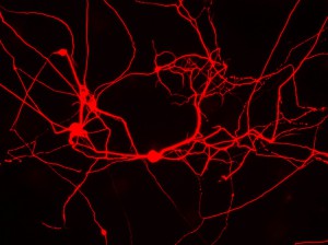 Imagem da notícia - Composto interrompe morte de neurônios relacionada a doenças degenerativas