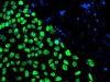 celula2
