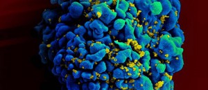 Célula infectada por vírus HIV - AP