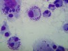 Macrófagos infectados in vitro com Leishmania braziliensis (imagem: Silvia Reni Bortolin Uliana).
