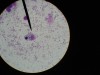 Leishmania donovani - spleen 2