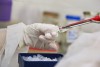Equipamento de baixo custo para detecção rápida de doenças infecciosas é desenvolvido no AM