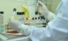 Teste vai permitir diagnosticar dengue, zika e chikungunya