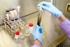 Pesquisa busca em fungos e bactérias potenciais farmacológicos para tratamento de doenças cardiovasculares