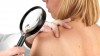Fuam abre inscrições para Jornada de Dermatopatologia