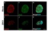 Estudo revela como o vírus zika mata as células cerebrais