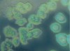 Estudo elucida mecanismo que torna as bactérias mais resistentes a antibióticos