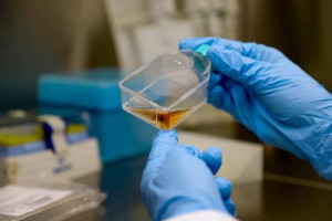 Imagem da notícia - Pesquisadores apontam eficácia do nitroestireno para o tratamento do melanoma, tipo mais agressivo de câncer de pele