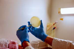 Imagem da notícia - Pesquisa encontra cepas bacterianas com potencial probióticos em peixes amazônicos